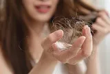 4 nguyên nhân phổ biến khiến vuốt nhẹ tóc cũng rụng cả nắm