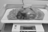 Phát hiện "thứ đáng sợ" nặng hơn 3kg trong bụng người phụ nữ 42 tuổi
