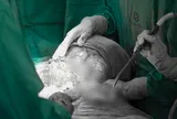 Người phụ nữ ở Hà Nội suy kiệt vì mang khối u khổng lồ 5kg