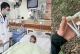 Suy đa tạng vì ăn nấm hái trong rừng