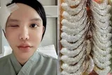 Người phụ nữ bị ký sinh trùng bò vào hốc mắt, suýt mù, bác sĩ cảnh báo 1 thói quen nhiều người Việt mắc phải