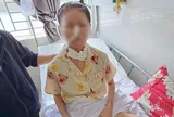 Cô gái 19 tuổi mắc căn bệnh 'tự tấn công mình' hiếm gặp