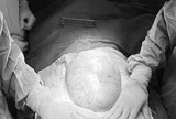 Bé gái 16 tuổi bụng to bất thường, bố mẹ sốc khi phát hiện bí mật "đáng sợ" bên trong