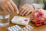 Có nên uống thuốc phòng đột quỵ?