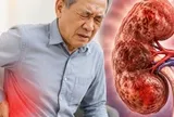 Bác sĩ chỉ: 6 DẤU HIỆU cảnh báo suy thận, nhưng dễ bị người Việt nhầm với vấn đề tuổi tác và mệt mỏi