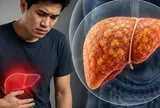 Gan nhiễm mỡ "ghé thăm" ngày càng nhiều người trẻ: Nếu có 7 THÓI QUEN này, bạn cần thay đổi ngay trước tuổi 40
