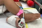 Bệnh hô hấp vào mùa, trẻ nhập viện gia tăng tại TP.HCM