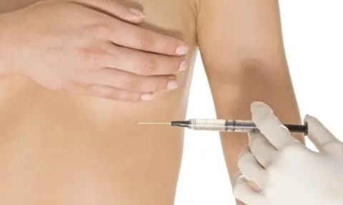 Tiêm filler nâng ngực đón Tết, người phụ nữ nhập viện vì áp xe nặng 0
