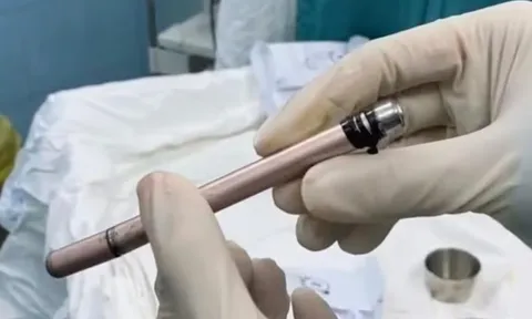 Thiếu nữ 16 tuổi nhập viện trong đêm sau tai nạn ngoài ý muốn