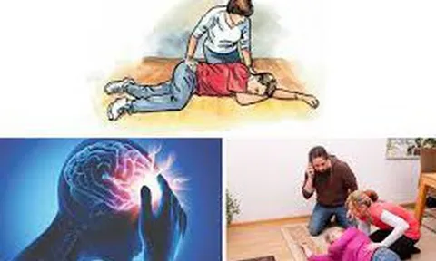 Đột quỵ não gia tăng và những dấu hiệu cảnh báo