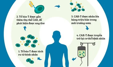 Liệu pháp CAR-T được dùng điều trị ung thư máu là gì? 0