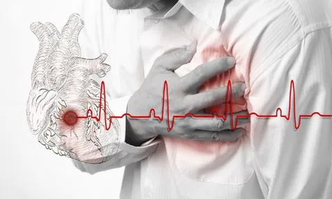 Đột quỵ dễ nhầm cơn say ngày Tết, bác sĩ chỉ dấu hiệu 'then chốt' giúp phân biệt 0