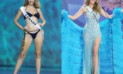 Hoa hậu 30 tuổi gây tranh cãi khi diễn áo tắm lúc mang bầu 4 tháng