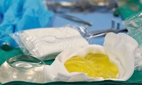 Vỡ túi ngực nhưng không hay biết