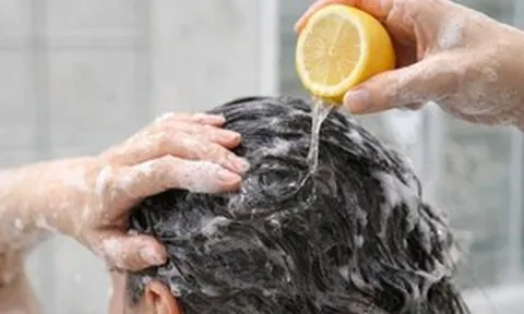 Lợi ích và rủi ro của việc gội đầu bằng chanh
