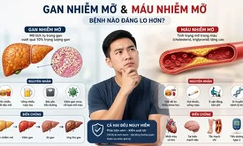 Gan nhiễm mỡ và máu nhiễm mỡ, bệnh nào đáng lo hơn?