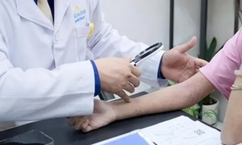 Cô gái phải đi khám gấp sau buổi đi bơi vì nổi mẩn đỏ khắp người