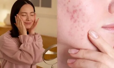 Tưởng chăm da kỹ, ai ngờ 5 thói quen này lại khiến lỗ chân lông nở to, da xuống cấp nhanh chóng