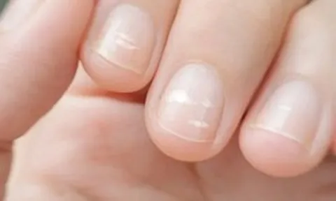 Ung thư có thể được phát hiện qua bàn tay? Bác sĩ cảnh báo: Xuất hiệu 5 dấu hiệu này, đừng nên chủ quan