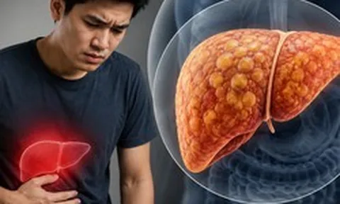Gan nhiễm mỡ "ghé thăm" ngày càng nhiều người trẻ: Nếu có 7 THÓI QUEN này, bạn cần thay đổi ngay trước tuổi 40