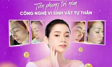 Chuỗi Viện Nám DR TRUNG LÊ: Nơi Mang Đến Giải Pháp Điều Trị Nám Tối Ưu