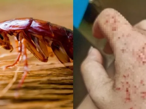 Điều gì xảy ra nếu chúng ta bị gián cắn? 0