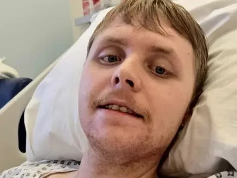 Não chàng trai 24 tuổi già như người 70, bác sĩ không tin vào kết quả chụp MRI 0