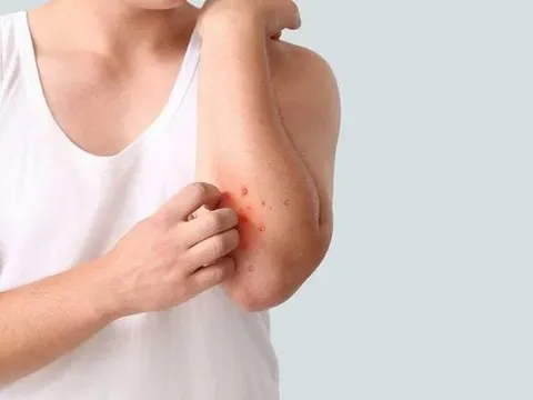 Người đàn ông 40 tuổi phát hiện ung thư gan giai đoạn cuối: Đáng tiếc ông đã bỏ qua dấu hiệu suốt 3 tháng