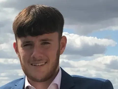 Triệu chứng nguy hiểm bị bỏ qua, chàng trai 20 tuổi tử vong vì 'vi khuẩn ăn thịt người' 0