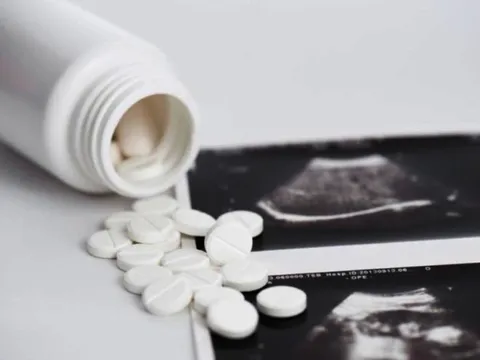 Tự uống 20 viên thuốc phá thai mua online, người phụ nữ phải cắt toàn bộ tử cung 0