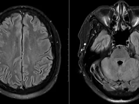 Cảnh báo hệ lụy từ món ăn "lấy may" của nhiều gia đình vào ngày Tết