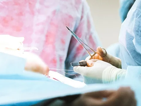 Ung thư có nên phẫu thuật? 0