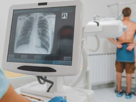 Chụp X-quang 'bấm là xong', sao phải chờ đủ 6 phút mới được BHYT thanh toán? 0