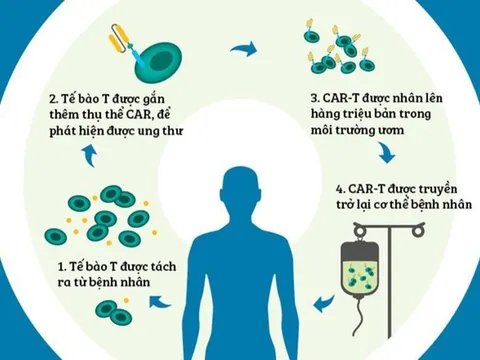 Liệu pháp CAR-T được dùng điều trị ung thư máu là gì? 0