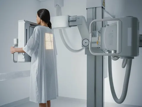 Bộ Y tế: Chụp X-quang đủ 6 phút không phải căn cứ duy nhất để trả bảo hiểm y tế 0