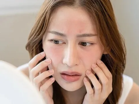 3 bước chăm sóc da nên tạm ngưng trong dịp Tết