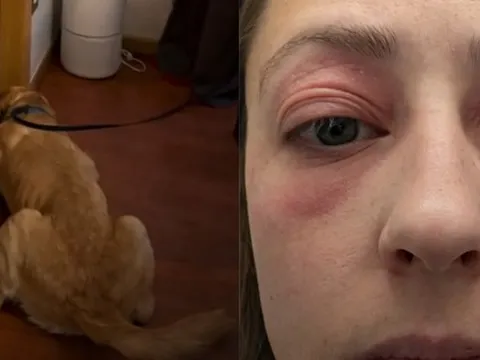 Bỏ 10 tỷ mua nhà, dọn vào ở được vài tháng, người phụ nữ mắc phải căn bệnh lạ khiến cơ thể biến dạng