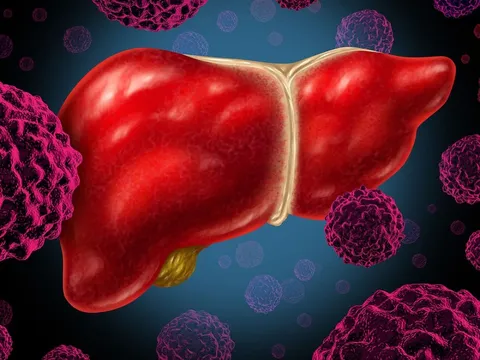 Phát hiện 'thủ phạm' âm thầm 'nuôi' tế bào ung thư trong gan: Không phải rượu bia hay thuốc lá