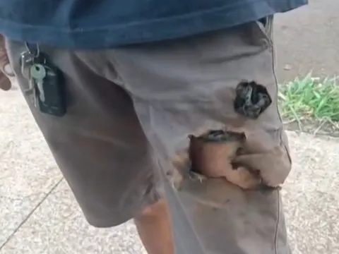 Điện thoại phát nổ cứu sống một người khỏi nanh vuốt chó dữ