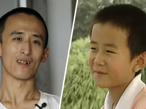 Thần đồng 10 tuổi vào đại học, 16 tuổi lấy bằng Tiến sĩ: Nay thất nghiệp, sống "ăn bám bố mẹ"