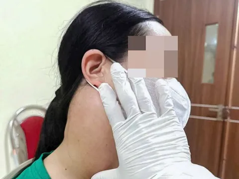 Từ chối xạ trị để dùng thảo dược chữa ung thư, u di căn rộng sau 3 năm