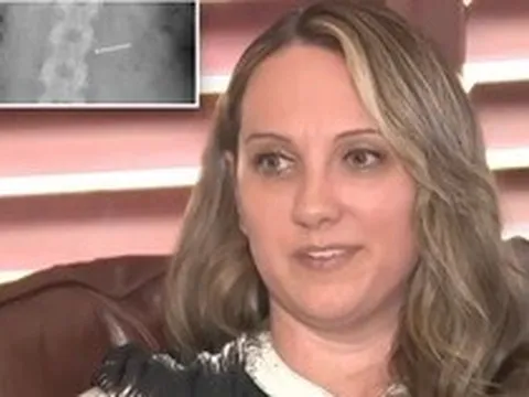 Ăn phải kem có chứa đinh sắt, người phụ nữ được bồi thường 364 tỷ đồng