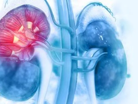 2 quả thận bị "bóp nghẹt", "xuống cấp" nhanh hơn chỉ vì 5 thói quen gặp ở nhiều người Việt