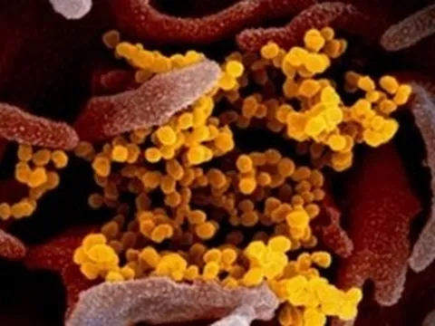 Biến thể COVID-19 'Ve sầu' né vaccine, lây nhanh tại Mỹ: Bộ Y tế cảnh báo gì?