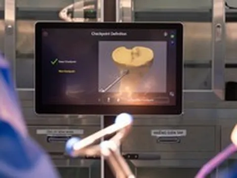 Công nghệ robot mới được triển khai tại bệnh viện của tỷ phú Phạm Nhật Vượng: Tích hợp “trợ lý” AI, sai số phẫu thuật dưới 1mm