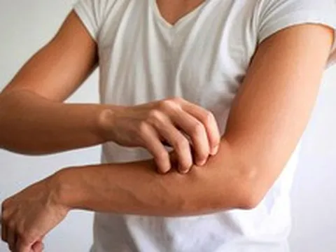 Cảnh báo: Ngứa da về đêm có thể là dấu hiệu sớm của bệnh suy thận