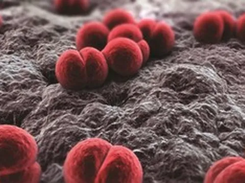 Viêm màng não mô cầu "sát thủ 24 giờ", bác sĩ cảnh báo nguy cơ