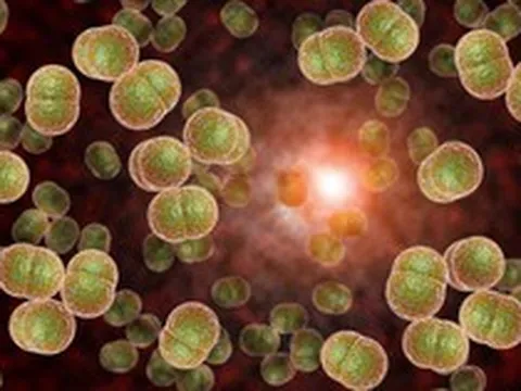 Vi khuẩn “ẩn mình” trong họng, có thể gây tử vong trong vòng 24 giờ