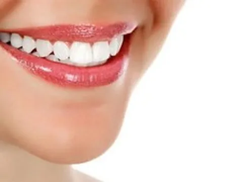 Mách bạn nhiều làm trắng răng tại nhà vừa dễ vừa an toàn