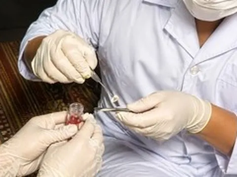 Món quà ánh sáng từ đôi giác mạc của người phụ nữ 61 tuổi